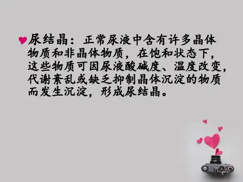 推荐精选尿液结晶