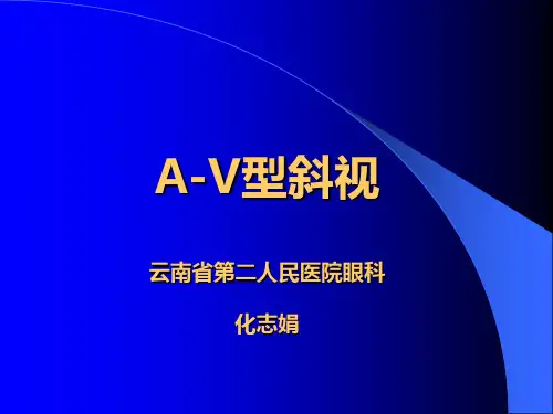 A―V型斜视