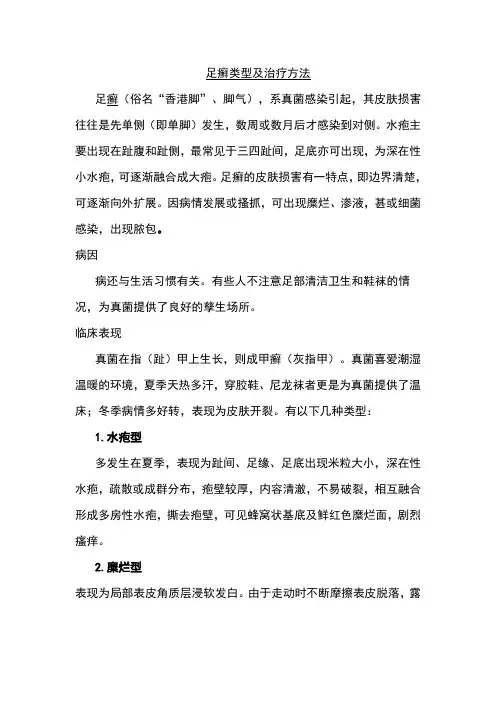 足癣类型及治疗方法