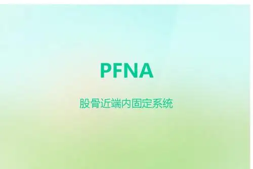 PFNA股骨近端内固定系统
