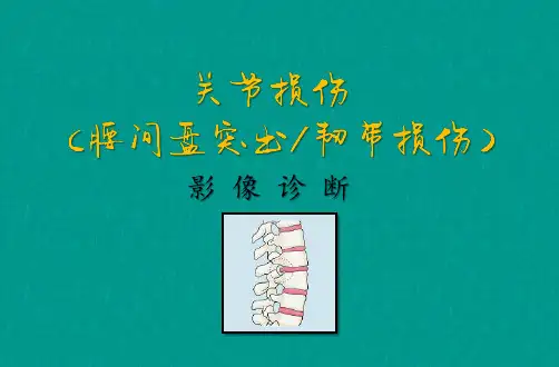 腰间盘突出及关节损伤影像诊断