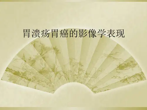 胃溃疡胃癌的影像学表现