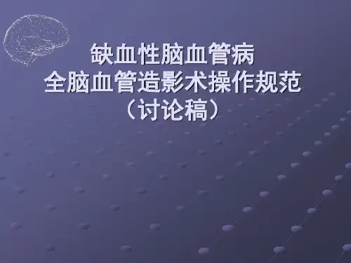 缺血性脑血管病全脑血管造影术操作规范(讨论稿)