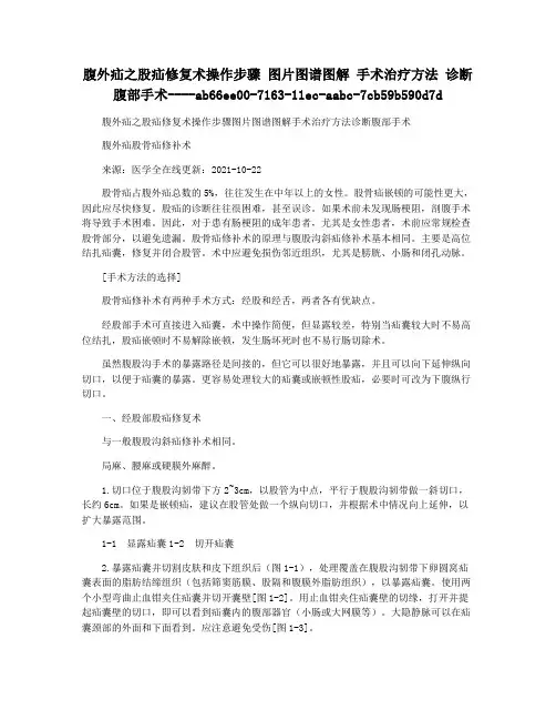 腹外疝之股疝修复术操作步骤 图片图谱图解 手术治疗方法 诊断腹部手术