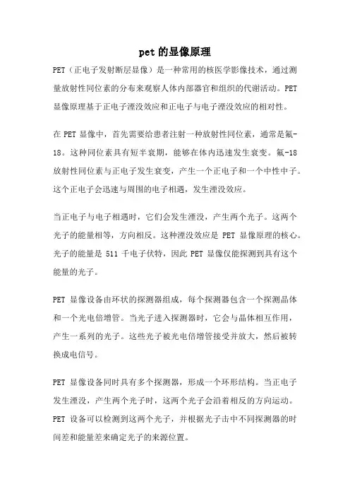 pet的显像原理