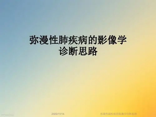 弥漫性肺疾病的影像学诊断思路