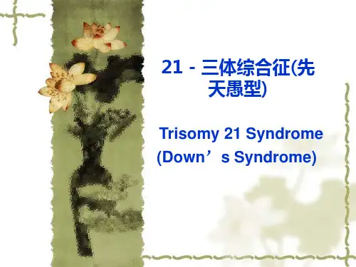 21-三体综合征,苯丙酮尿症,先天性甲状腺功能减低症,儿童糖尿病