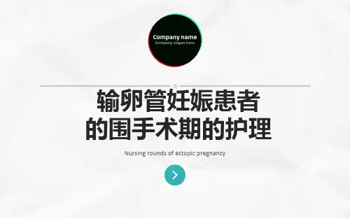 宫外孕的护理查房PPT课件