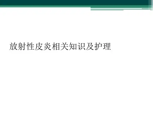 放射性皮炎相关知识及护理