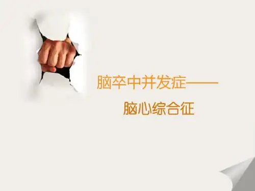 脑卒中并发症之脑心综合征