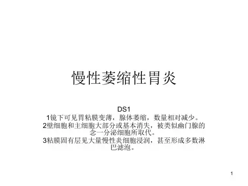 慢性萎缩性胃炎PPT课件