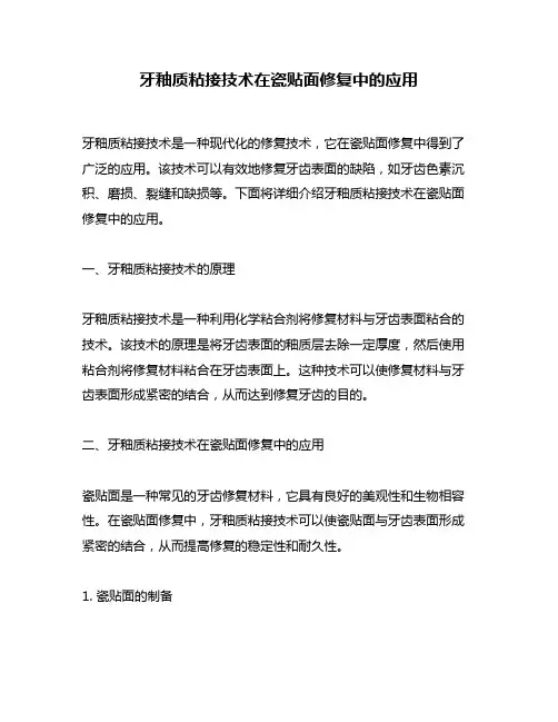 牙釉质粘接技术在瓷贴面修复中的应用