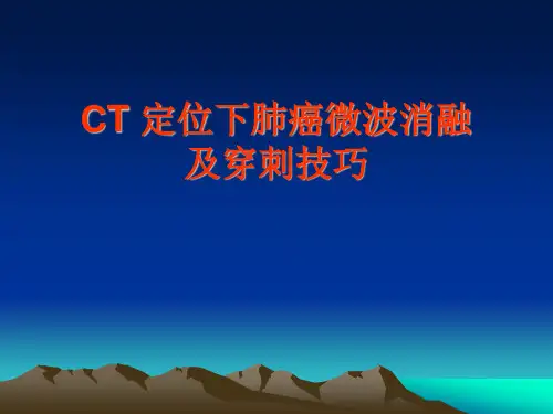 CT定位下肺癌微波消融及穿刺技巧【103页】