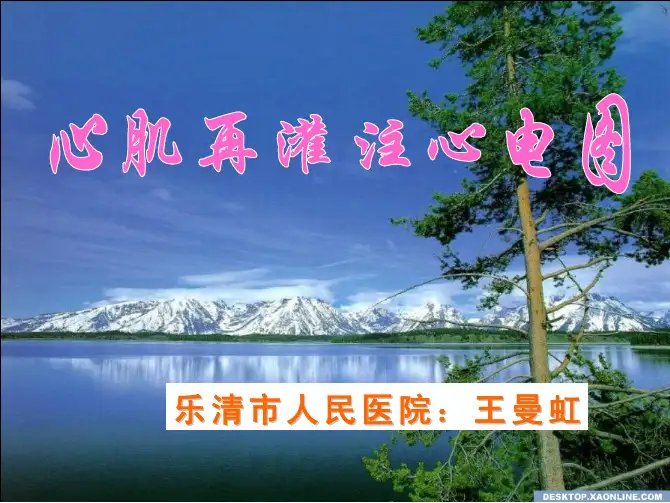 心肌再灌注心电图