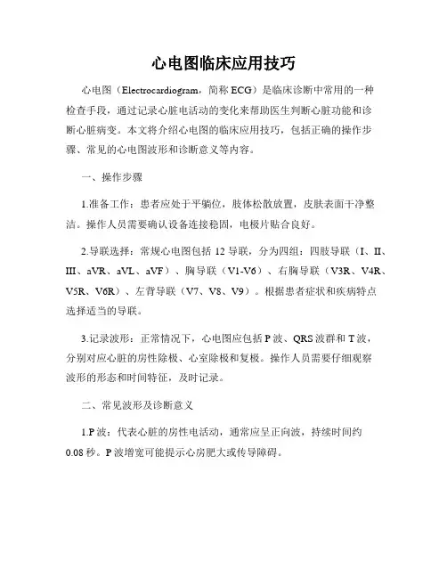 心电图临床应用技巧