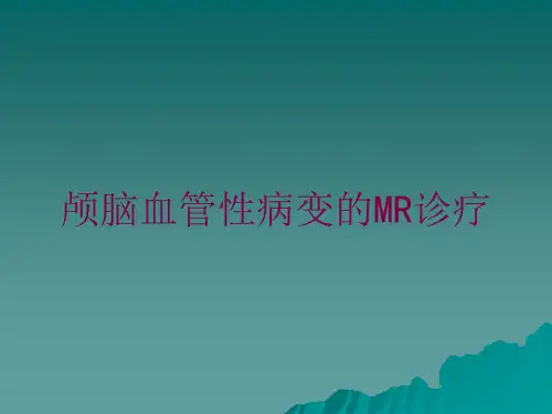 颅脑血管性病变的MR诊疗培训课件