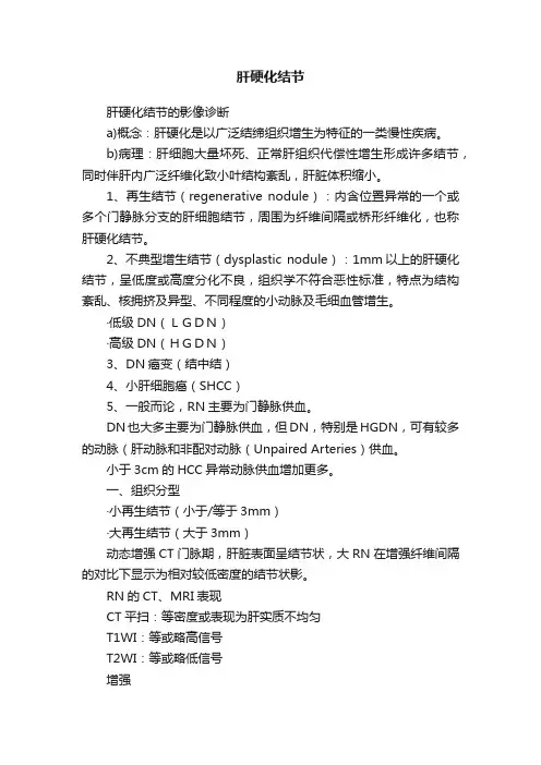 肝硬化结节
