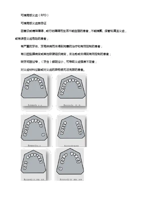 口腔主治医师口腔修复学-牙列缺损修复