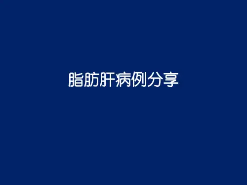 脂肪肝病例