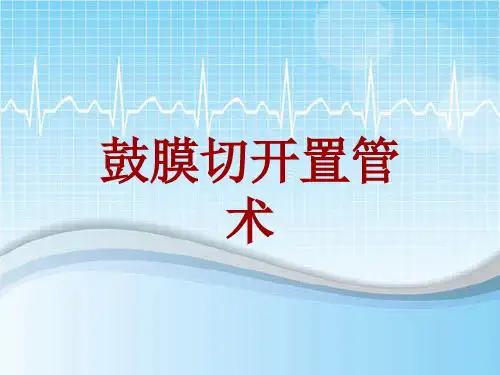 手术讲解模板：鼓膜切开置管术