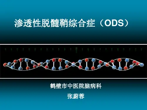 渗透性脱髓鞘综合症