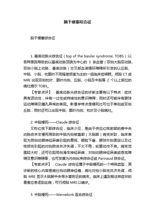 脑干梗塞综合征