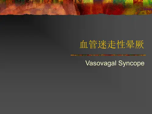 血管迷走性晕厥知识讲解