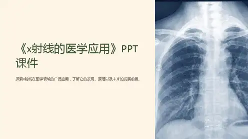 《x射线的医学应用》课件
