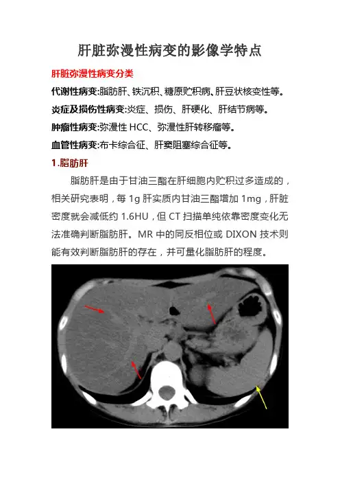 肝脏弥漫性病变的影像学特点