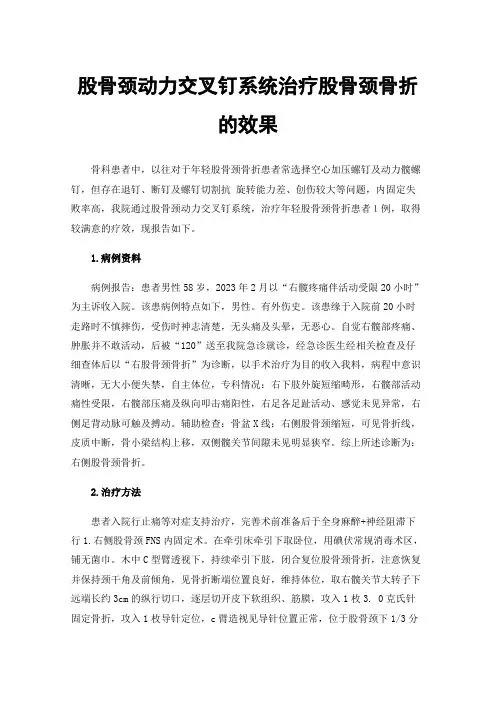 股骨颈动力交叉钉系统治疗股骨颈骨折的效果