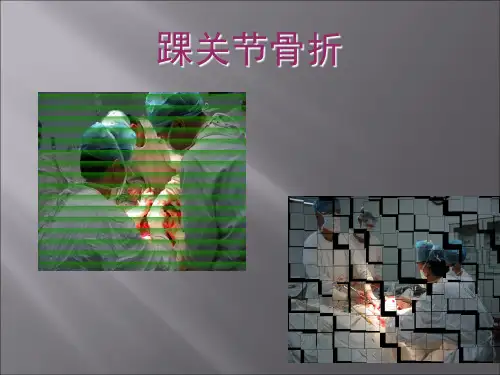 踝关节骨折参考PPT
