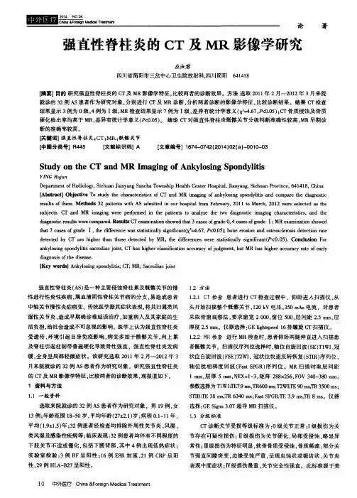 强直性脊柱炎的CT及MR影像学研究