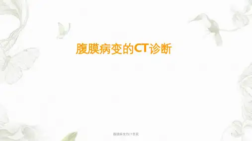 腹膜病变的CT表现ppt课件