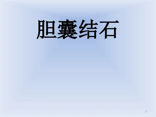胆囊结石小讲课PPT课件