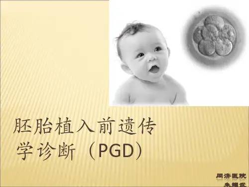 PGD