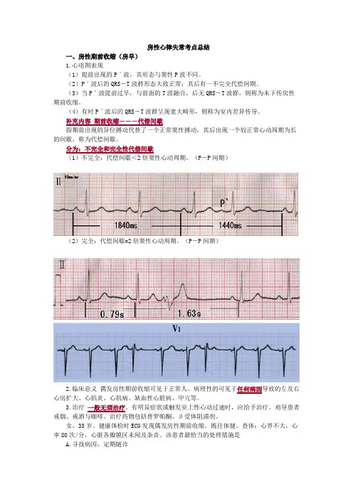 房性心律失常考点总结