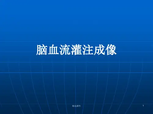 脑血流灌注成像