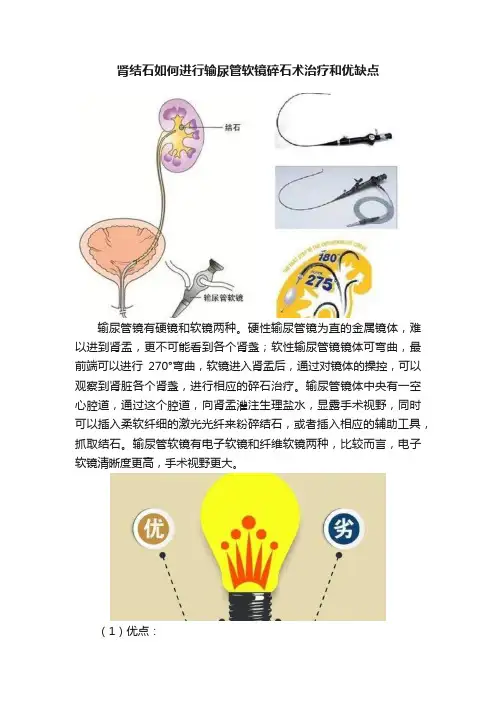 肾结石如何进行输尿管软镜碎石术治疗和优缺点