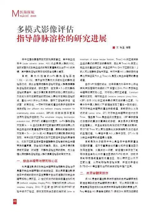多模式影像评估指导静脉溶栓的研究进展