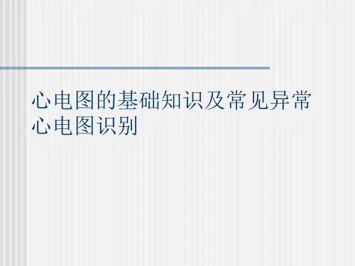 心电图的基础知识及常见异常心电图识别课件