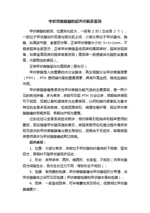 甲状旁腺腺瘤的超声诊断及鉴别