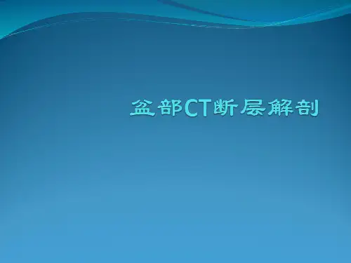 盆腔CT断层解剖