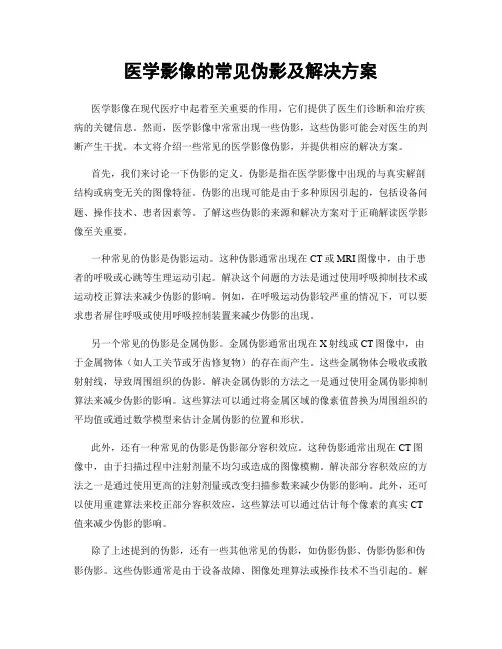医学影像的常见伪影及解决方案