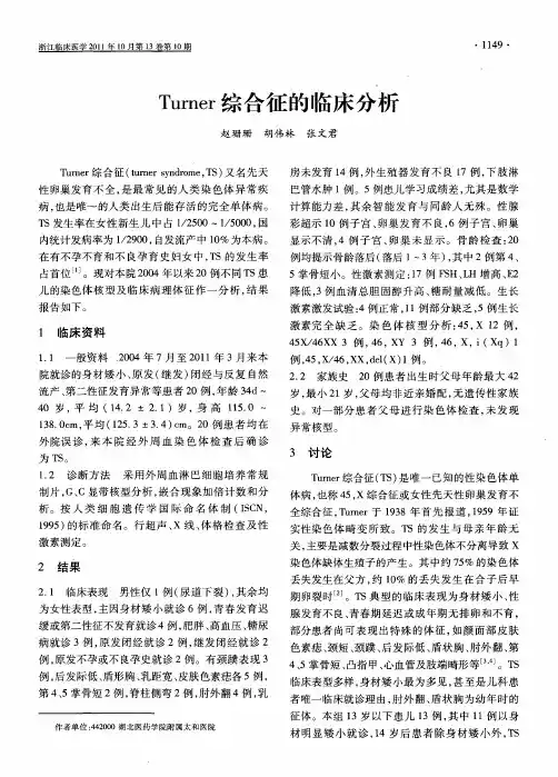 Turner综合征的临床分析