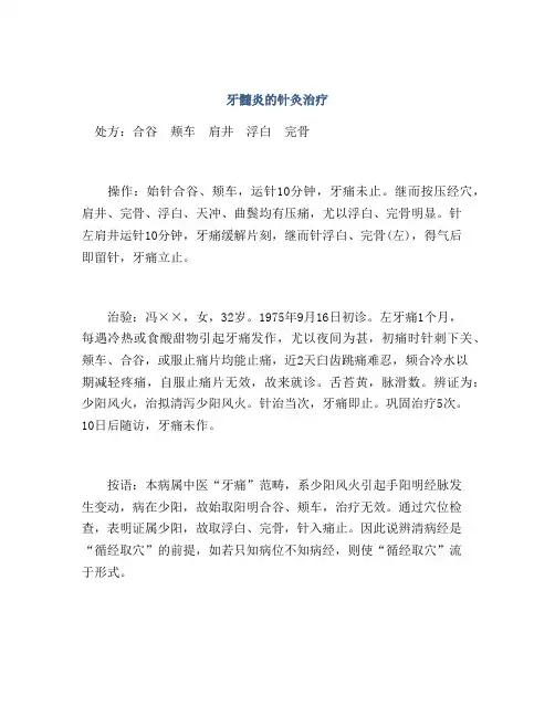 牙髓炎的针灸治疗
