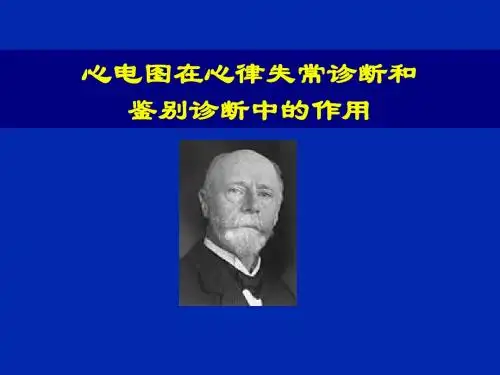 心电图在心律失常诊断和鉴别诊断中的作用