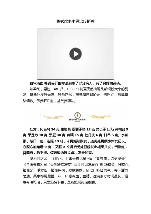 陈秀珍老中医治疗斑秃