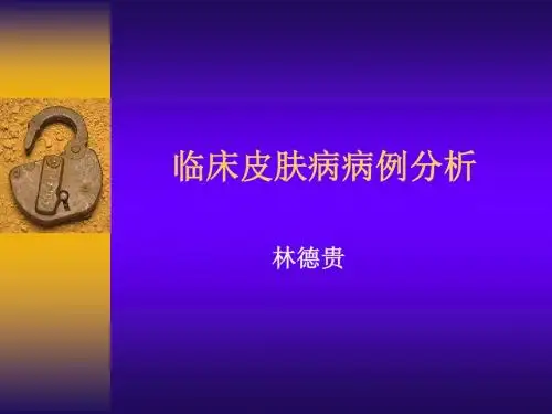 临床皮肤病病例分析ppt课件
