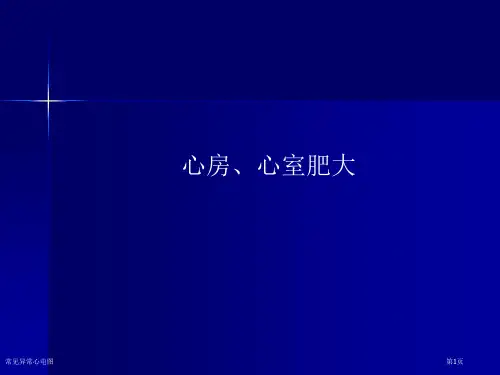 常见异常心电图
