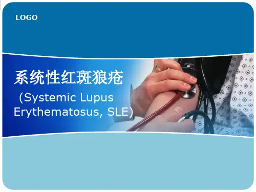系统性红斑狼疮课件PPT课件